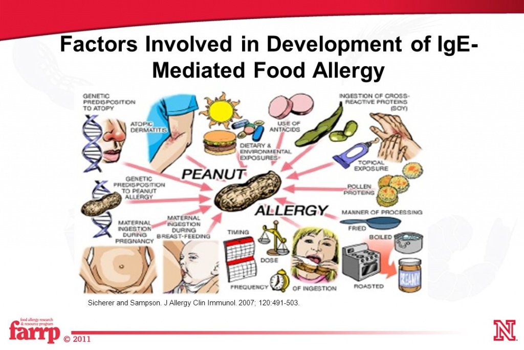 Alergia Alimentar Mediada Por Ige Igastroped