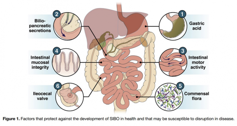 Sobrecrescimento Bacteriano No Intestino Delgado (SIBO) Associado A ...